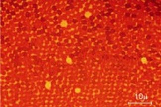  A sárgafolt mikroszkópi képe (Forrás: Orvosi Fizikai Gyakorlatok)